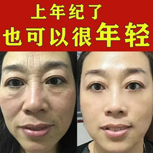 【南京同仁堂】类蛇毒眼霜去黑眼圈眼袋淡化细纹去脂肪粒淡化提拉紧致男女士学生眼部精华集草惠 两瓶优惠装