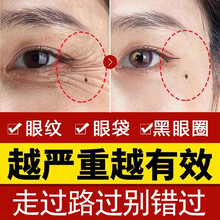 南京同仁堂蛇毒眼霜淡化细纹眼袋眼部精华淡化黑眼圈抗皱眼霜淡化细纹提拉紧致改善脂肪粒男女通用集草惠 两瓶优惠装