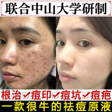 草本旋律 中大祛痘印水杨酸果酸去男士女痘坑修复凹洞痘疤淡化痘印收缩毛孔玻色因精华液补水保湿细嫩去闭口 买2享3