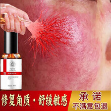 九叶草红血丝脸部发红发烫敏感高原红激素脸角质薄男女精华液增厚角质层补水保湿舒缓修护液 红1瓶装【改善肌肤，修复角质层】
