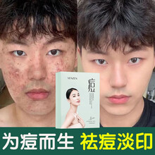 【黄圣依同款】祛痘面膜女男护肤品 积雪草玻尿酸补水保湿收缩毛孔 去痘去黑头粉刺闭口控油淡化痘印梵贞 三盒超值装=118【买2 送1，祛痘不反复】