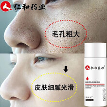 仁和匠心 收缩毛孔精华液原液毛孔粗大收缩脸部修复细致毛孔缩小堵塞疏通紧致保湿细致补水男女通用爱肤宜 1瓶装【100ml收缩毛孔体验装】
