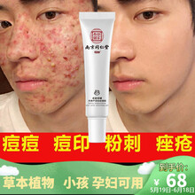 南京同仁堂亦生堂 祛痘膏 祛痘印 痤疮膏 痘坑修复 青春痘闭口粉刺淡化男女学生 丹参芦荟祛痘凝胶 单只/20ml（一支体验装）