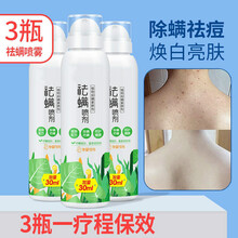优工坊祛痘祛螨植物喷剂除螨皂防螨杀虫家用床上全身 祛螨喷剂3瓶装【后背痘全消】