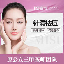 可月 蜜司医疗美容 医疗美容 控油祛痘/平肤 舒缓 收缩毛孔 祛痘坑痘印 嫩肤提亮