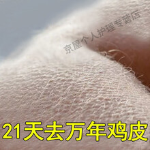 鸡皮肤白色块(白色鸡皮肤图片) 鸡皮肤白色块(白色鸡皮肤图片)