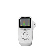 便携式肢体外周血管血流速度检测观察仪医用超声多普勒血流检测仪 有打印机