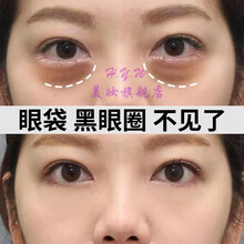 肌皙源红蛇毒眼膜淡化黑眼圈皱纹紧致抗皱西班牙进口类蛇毒肽胶原眼膜30对 红蛇毒眼膜3盒90对囤货装