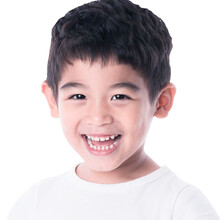 瑞泰口腔 窝沟封闭 预防蛀牙龋齿童龋齿牙齿护理 靖江/江阴