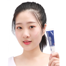 可孚 壳聚糖护创凝胶疤痕膏痘印手术凹凸伤疤妊娠纹疤痕 1盒装-适合小疤痕痘印等