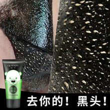 怎么去黑头鸡皮疙瘩(去黑头的可以去鸡皮肤吗)