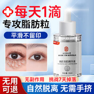 南京同仁堂脂肪粒去除神器眼部专用去眼部脂肪粒黑眼圈清肌颗粒眼部精华液 3瓶装【只需2瓶价】