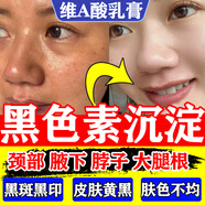 脸部排毒排黑色素去斑去黑色素沉淀脸上黑斑点黑色素去除脸部医用色素下暗沉关节大腿根黑去黑药膏维A酸乳膏 1盒【维a酸i乳膏 祛斑专用药脸部】