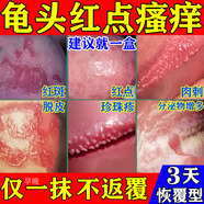 龟头炎专用药真菌感染包皮炎珍珠疹念珠菌霉菌性龟头炎红点肿瘙痒包皮白垢豆腐渣专用男科用药硝酸咪康唑乳膏 5盒【告别198种男私问题】好后可停药