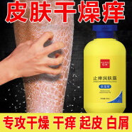 止痒润肤露止痒皮肤干燥起皮夏季皮肤热痒刺挠秋冬保湿露 1瓶装