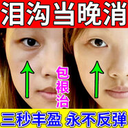 泪沟填充神器修复法令纹眼窝脸部凹陷液去除眼袋黑眼圈鱼尾纹精华 单盒装