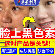 脸上黑斑点黑色素可搭配去除脸部排毒排黑色素黑色素沉淀面部去斑去黑色素脸部医用色素下暗沉膏使用N3 一盒 白愈康膏 送棉签【脸上黑色素】建议疗程使用