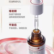 花月娇原液洋甘菊玻尿酸樱桃茶树六胜肽五款可选补水修复祛痘退印当天发 花月娇草本祛痘精华