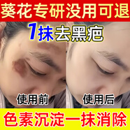 去除脸上黑色素沉淀淡化痘印去疤痕去色素沉着结痂黑印修复药膏 一盒装【色素沉淀】