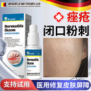 DR.AVIN医用闭口粉刺喷雾脸上起小疙瘩毛孔堵塞可搭祛痘消炎克星药膏GU 一盒【轻度痤疮表现】儿童/青少年可用