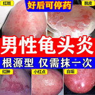 克霉唑乳膏软膏男性私处真菌感染龟头炎白垢豆腐渣专用药龟头炎专用药膏真菌感染念珠菌霉菌皮肤用药非处方药 5盒【告别男言之隐】从跟入手 好的彻底