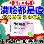 丹参酮胶囊祛痘消炎痤疮专用药硬疙瘩去痘痘修复消炎痘印去粉刺黑头闭口粉刺青春痘疙瘩红肿硬块皮肤口服中药 10盒【长期痤疮 满脸痘痘】周期治疗