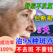 藤原石川制薬脸上手上100%强傚第1名淡化老年黄褐雀斑黑色素一夜消专用的药W 特校淡斑神器【2025新科技】单盒装
