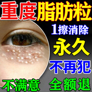 脂肪粒去除药膏神器眼部专用眼霜消除汗管瘤脂肪油脂粒粟丘疹克星 特效:买2送1【快速去除】 脂肪粒去除神器眼周去小颗粒清肌