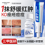 皮傲宁焕颜净透凝胶点涂祛痘精华液
