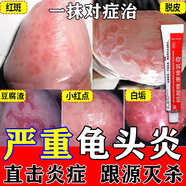 [扬子洲]硝酸咪康唑乳膏 2%*20g 5盒装 龟头炎白垢豆腐渣专用药龟头炎专用膏药龟头真菌感染红肿念珠菌霉菌包皮炎私处痒 休想龟头炎 告别男炎之隐