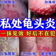 龟头炎白垢豆腐渣专用药克霉唑乳膏男性真菌感染龟头炎私处止痒杀菌男士龟头炎真菌感染专用药包皮龟头炎软膏 5盒【告别男言之隐】好后无需复购