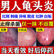 [华青]红霉素软膏 1%*8g 5盒装 私处男士龟头炎真菌感染专用药龟头炎白垢豆腐渣专用药男性龟头炎症专用真菌感染红肿瘙 仅需一次告别难言之隐