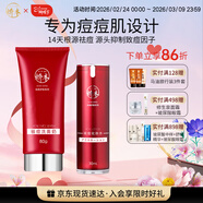 娇本（jiaoben）男女青春痘熬夜痘姨妈痘保湿去黑头粉刺白头14天无酸祛痘化妆品 源头无酸祛痘洁面+化妆水