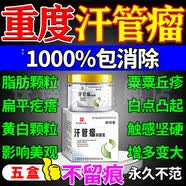 泉语寻汗管瘤专用眼部去除神器药膏眼周脂肪粒扁平粟丘疹油脂粒专用薬 5盒重度范