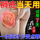 同仁堂北京同仁堂褥疮膏药进口专用喷雾生肌膏 褥疮溃烂老人皮肤溃烂烂 买三送二中度专用