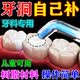 南京同仁堂补牙洞材料神器自己在家补牙牙齿断牙蛀牙临时填充新型补牙缝 一瓶装【掌柜主推】