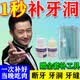 补牙材料自己在家补牙齿龋齿缺口修复医用填充树脂牙洞牙缝填充剂 基础版【补牙瓷粉】送口镜+探针