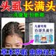 头虱子药儿童头上长虱卵小女孩成人头发虱去除虱卵一扫光百部酊皂 单盒 古方传承