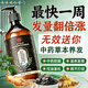 同仁堂防脱育发洗发水生姜头发增防脱发控油蓬松草本老姜王固发养发400g
