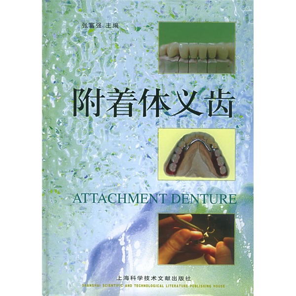 附着体义齿
