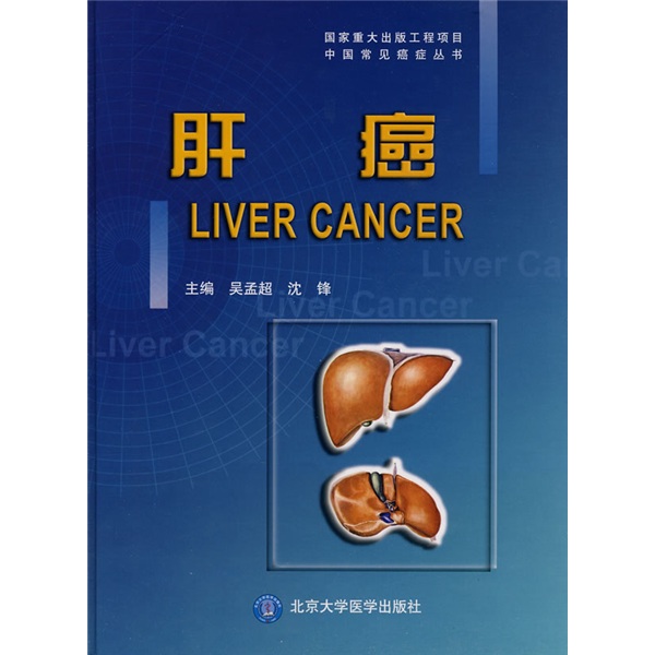 国家重大出版工程项目中国常见癌症丛书：肝癌