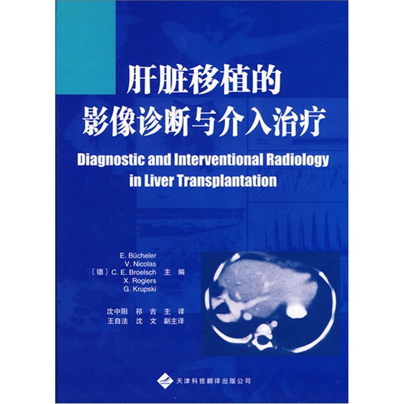 正版现货 肝脏移植的影像诊断与介入治疗9787543323100津科翻译