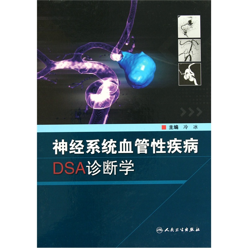 神经系统血管性疾病DSA诊断学
