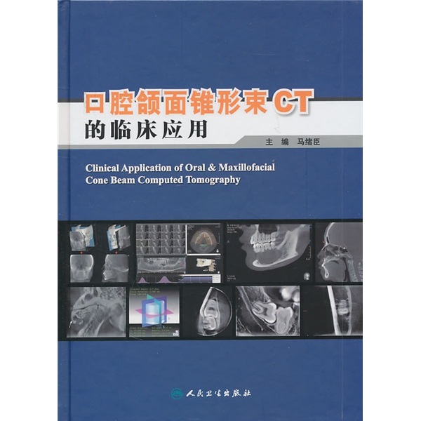 口腔颌面锥形束CT的临床应用