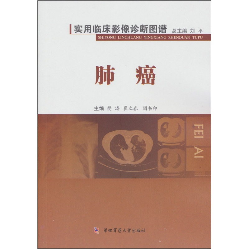 实用临床影像诊断图谱:肺癌