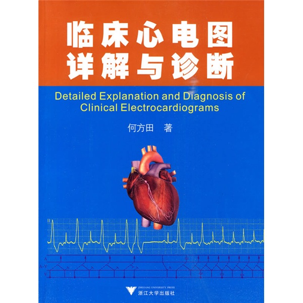 临床心电图详解与诊断