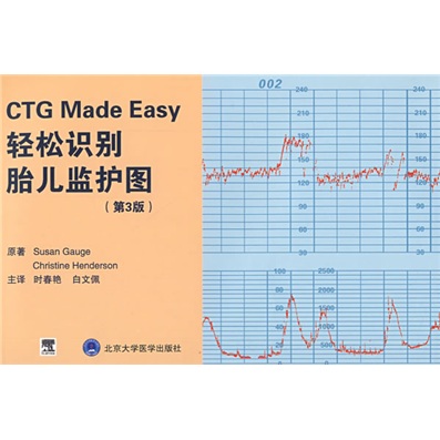 轻松识别胎儿监护图(第3版)