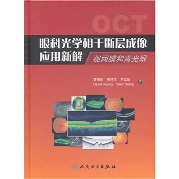 眼科光学相干断层成像应用新解：视网膜和青光眼