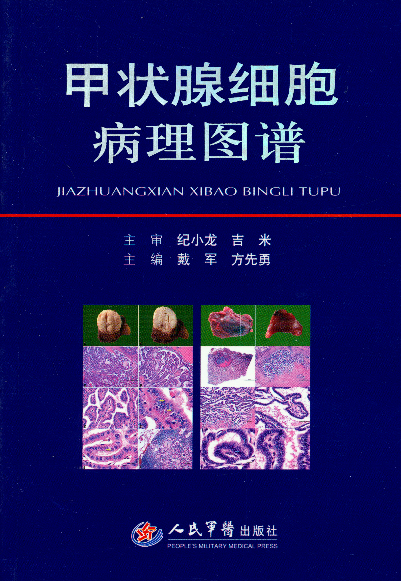 甲状腺细胞病理图谱