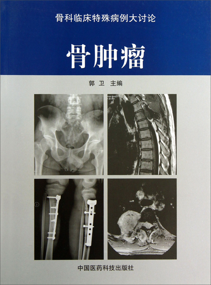 骨肿瘤